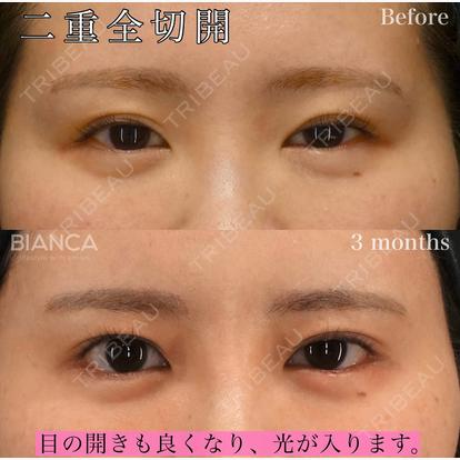 新行内 芳明の症例
