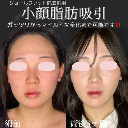 橋本 英樹先生の症例