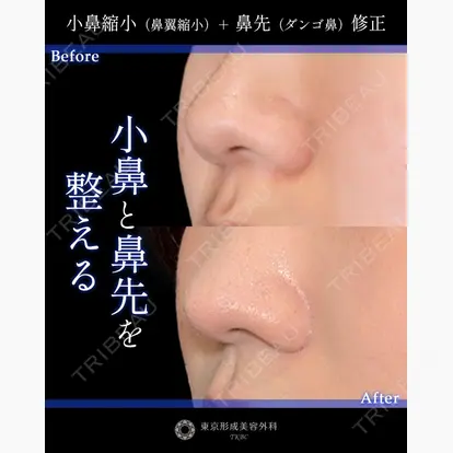 山崎 修吾先生の症例