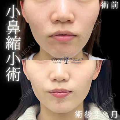 藤井　美香子先生の症例