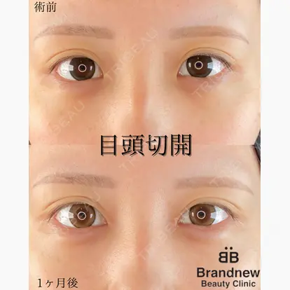 平山 容成先生の症例
