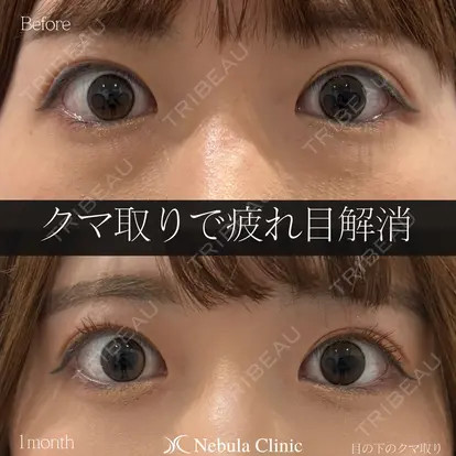 岩切 琢磨先生の症例