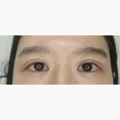 井田 雄一郎先生の症例