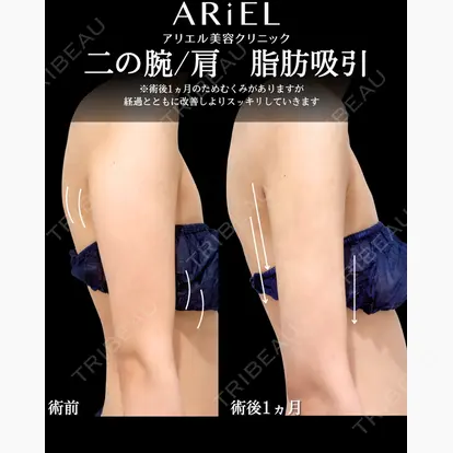 加藤 敏次先生の症例