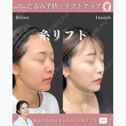 梅田 絢乃先生の症例