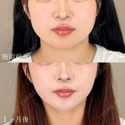 山本 展生先生の症例