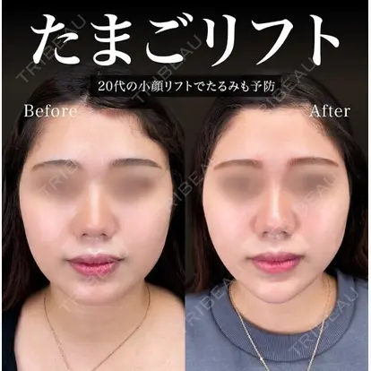 岡本 卓也先生の症例