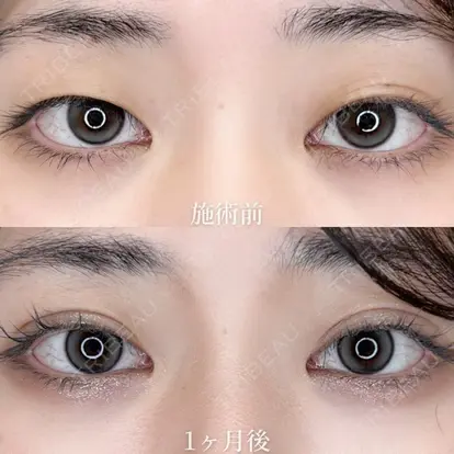 古賀 唯礼先生の症例
