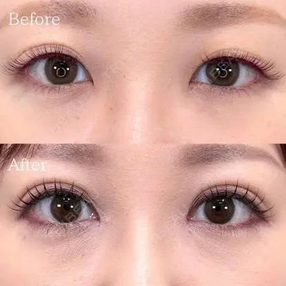 三好 翔輝先生の症例