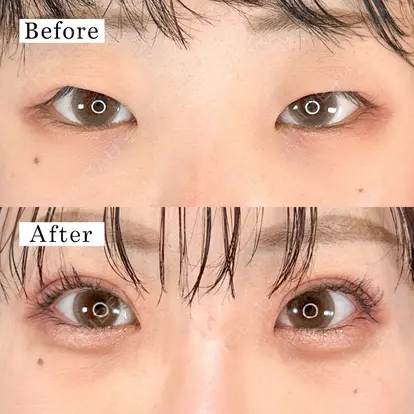 河村 宜生先生の症例