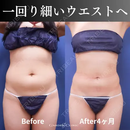 大庭 英信先生の症例