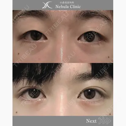 浦野 正樹先生の症例