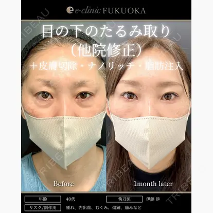 伊藤 渉先生の症例