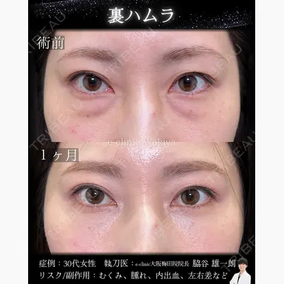 脇谷 雄一朗先生の症例