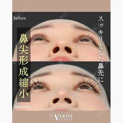 仲宗根 美佳先生の症例