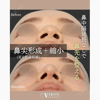 仲宗根 美佳先生の症例