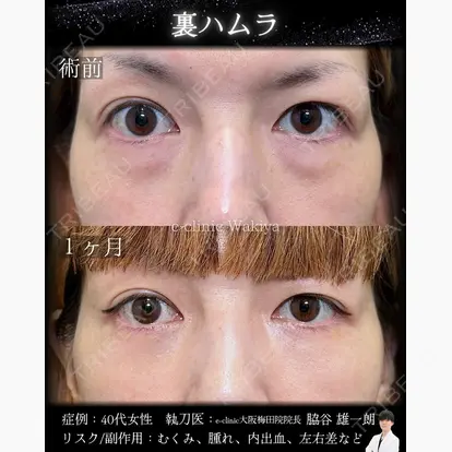 脇谷 雄一朗先生の症例