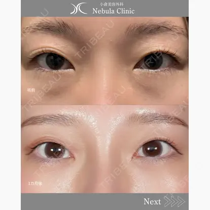 浦野 正樹先生の症例