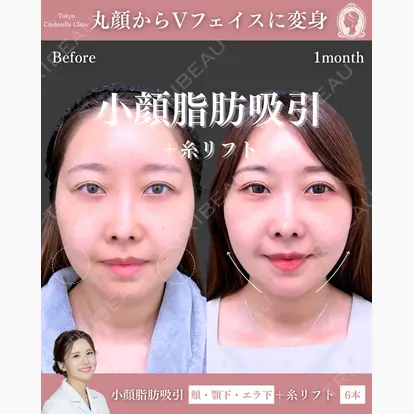 梅田 絢乃先生の症例