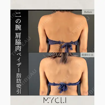 三木 晶森先生の症例