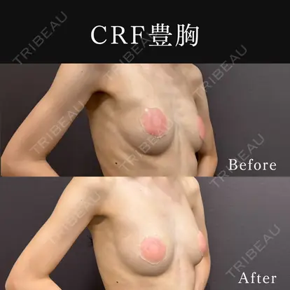 篠﨑 智公先生の症例