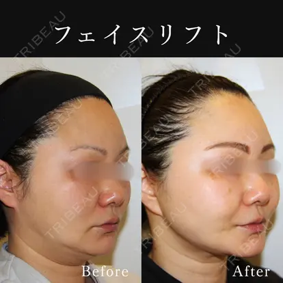 篠﨑 智公先生の症例