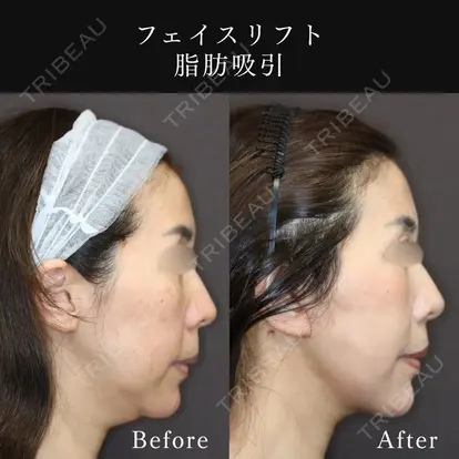 篠﨑 智公先生の症例