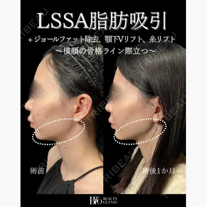 伊藤 富良野先生の症例