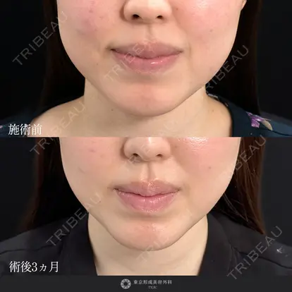 中尾 真紀先生の症例