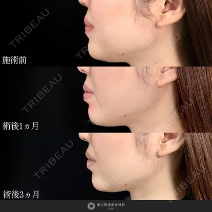 中尾 真紀先生の症例