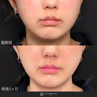 中尾 真紀先生の症例