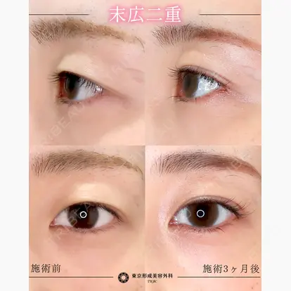 中尾 真紀先生の症例