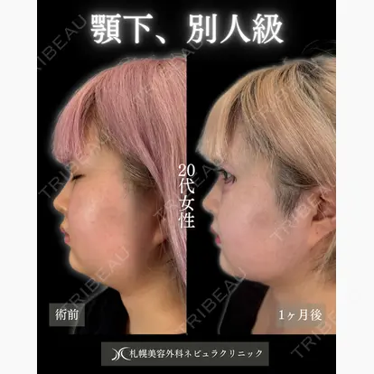 横田 開先生の症例