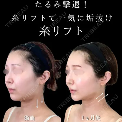 渡邉 光先生の症例