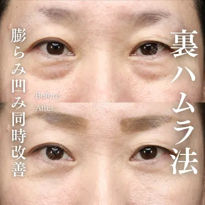 鈴木 大路先生の症例