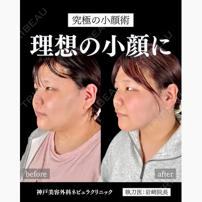 岩﨑 雅先生の症例