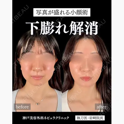 岩﨑 雅先生の症例