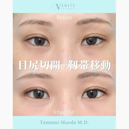 前田 珠未先生の症例