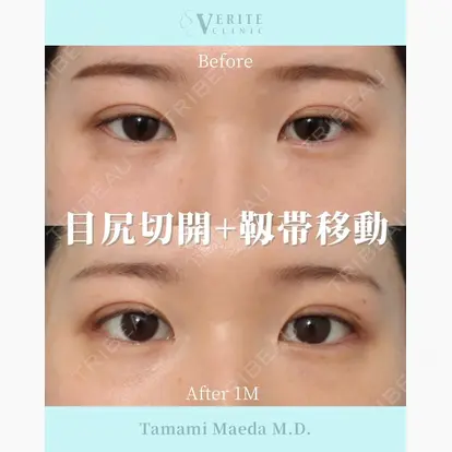 前田 珠未先生の症例