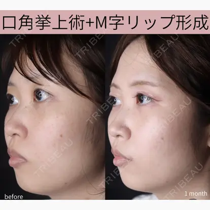 巴 窓花先生の症例