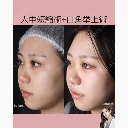 巴 窓花先生の症例