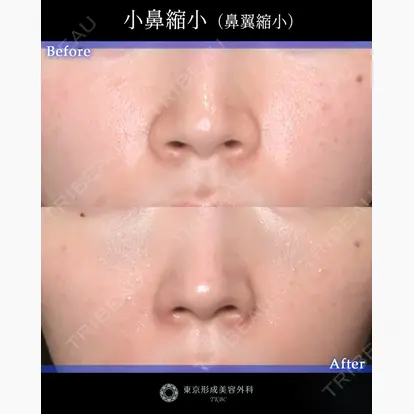 山崎 修吾先生の症例