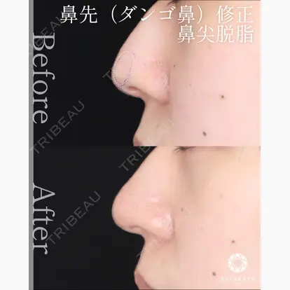 山崎 修吾先生の症例