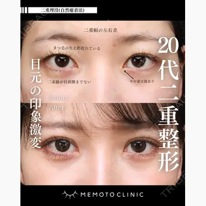 鈴木 大路先生の症例