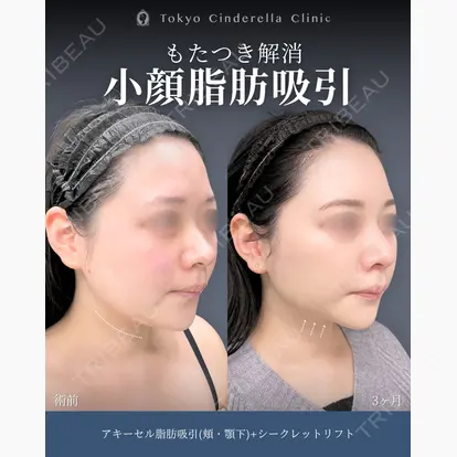 吉原 伯先生の症例