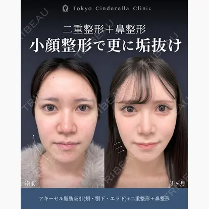 吉原 伯先生の症例