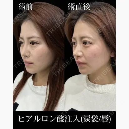 柳 立樹先生の症例