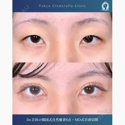 吉田 利之先生の症例