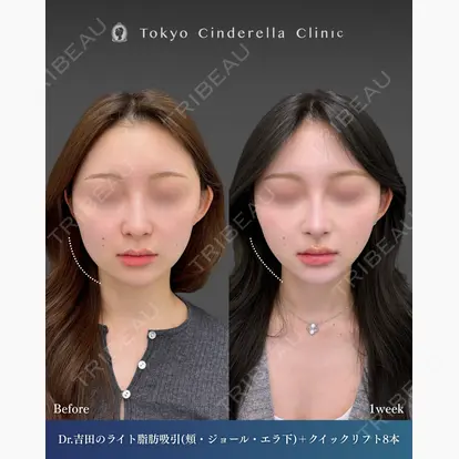 吉田 利之先生の症例