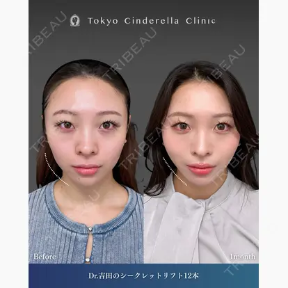 吉田 利之先生の症例